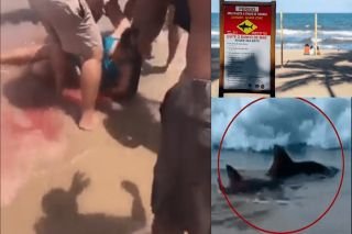 Mujer estadounidense pierde una pierna tras ataque de tibur&oacute;n