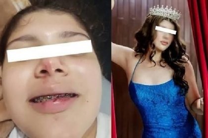 Necropsia de Dafne revela agua en los pulmones; indagan maltrato en academia