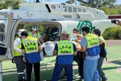 Atenci&oacute;n inmediata permite traslado a&eacute;reo de joven con quemaduras desde Acatl&aacute;n de Osorio
